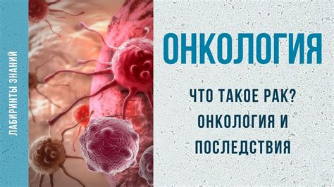 Что такое онкология?