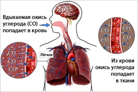 Что такое отравление газом: причины, симптомы и последствия