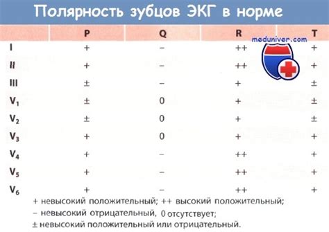 Что такое параметры QRS?