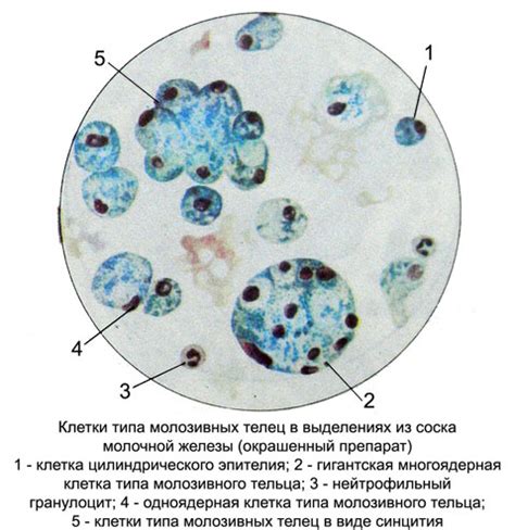 Что такое пенистые клетки типа молозивных телец?