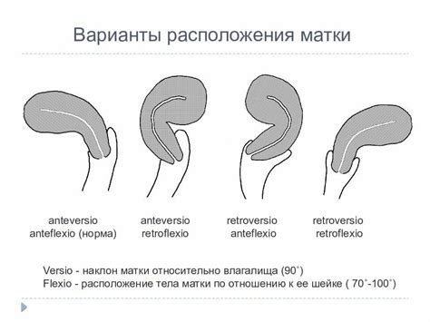 Что такое перегиб anteflexio?