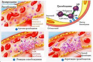 Что такое плохая свертываемость крови?