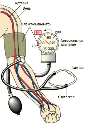 Что такое повышение кровяного давления?