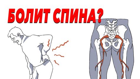 Что такое прихватило спину