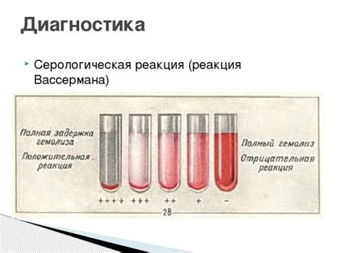 Что такое реакция Вассермана