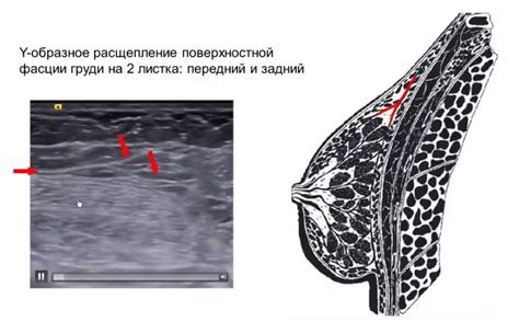 Что такое связки Купера?