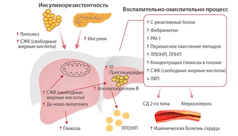 Что такое синдром дислипидемии?