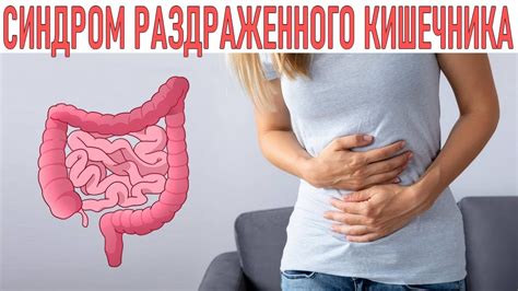 Что такое синдром раздраженного кишечника