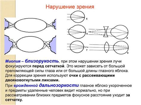 Что такое слабая степень близорукости?