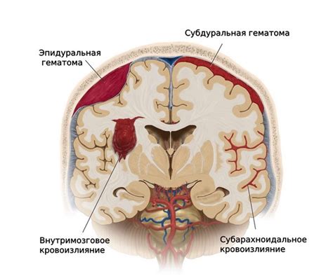 Что такое субарахноидальное пространство?