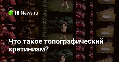 Что такое топографический кретинизм?