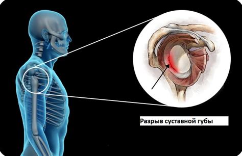 Что такое тупая губа?