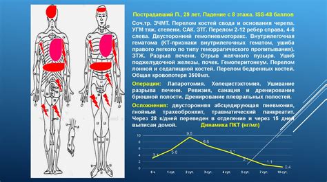 Что такое тяжелая сочетанная травма?