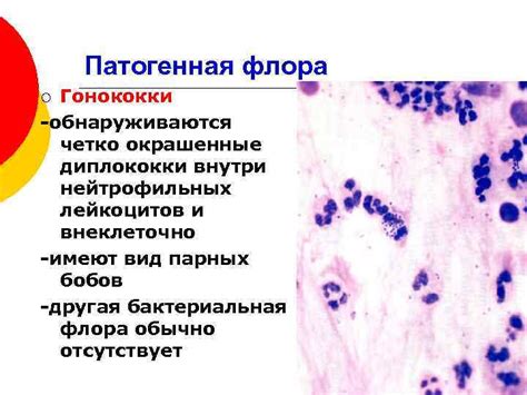 Что такое флора палочковая?