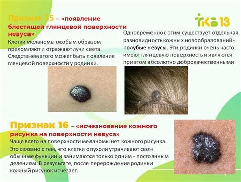 Что такое фолликулы на коже и как с ними бороться?