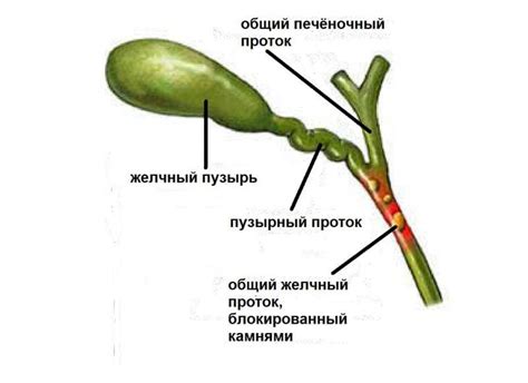 Что такое холедох и его визуализация?