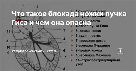 Что такое частичная блокада правого пучка Гиса?