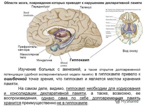 Что такое ширина третьего желудочка головного мозга?