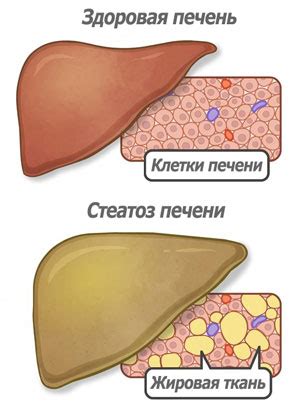 Что такое эхопризнаки печени