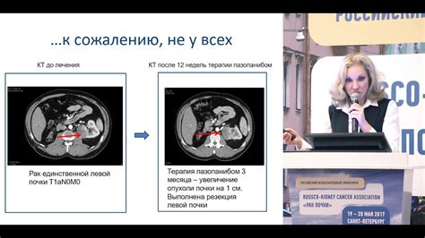 Что такое эхоскопическое исследование: основные принципы и методы