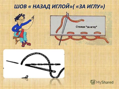 Шов назад иглой: общая информация