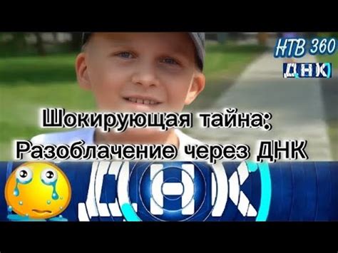 Шокирующая тайна: что скрывается за неожиданным укусом лисы во сне?