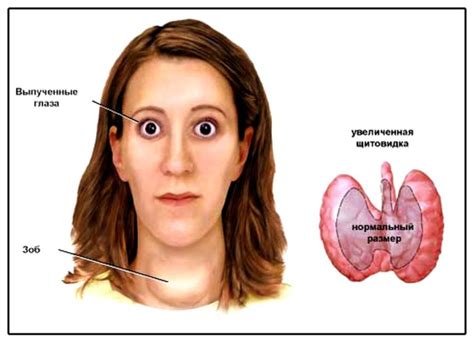 Щитовидная железа у женщин
