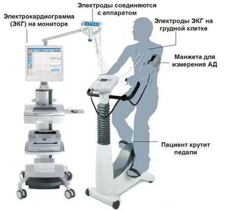 ЭКГ: как исключить патологии