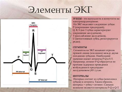 ЭКГ зубец Т положительный: значение, интерпретация и возможные причины