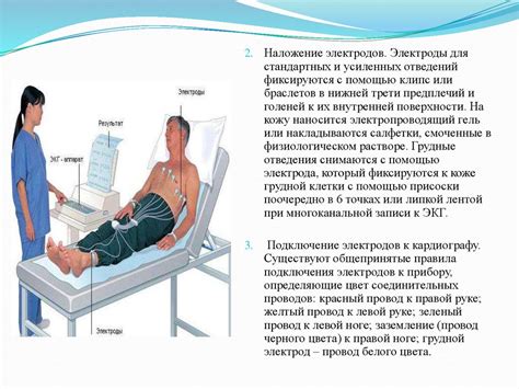 ЭКГ исследование