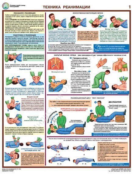 Экстренная реанимация: суть и принципы