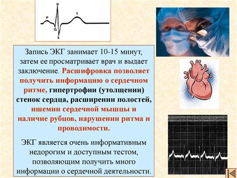 Электрокардиограмма – ключевой метод