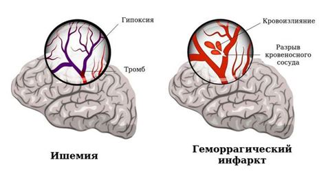 Энцелофапатия неуточненная