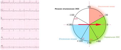 Эос неопределенная: