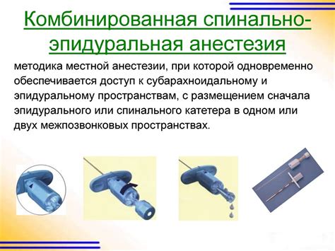 Этапы разработки анестезиологического пособия