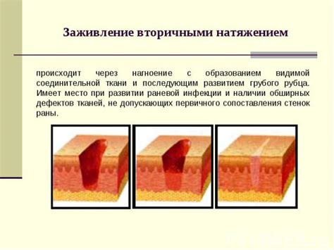 Этапы ревизии раны: что происходит на каждом этапе