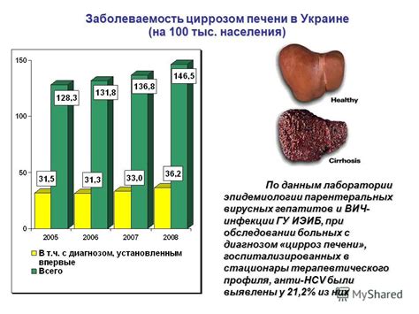 Эффективность гепатопротектора от болезней печени