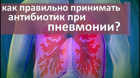 Эффективность гормональных капельниц при пневмонии