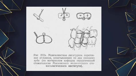 Эффективные методы лечения переломов зубов