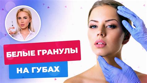 Эффективные средства для удаления гранул Фордайса на губах