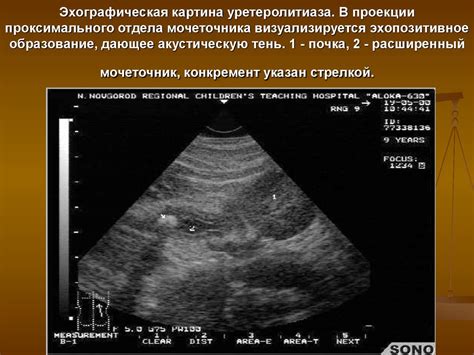 Эхопозитивное образование: суть и значение