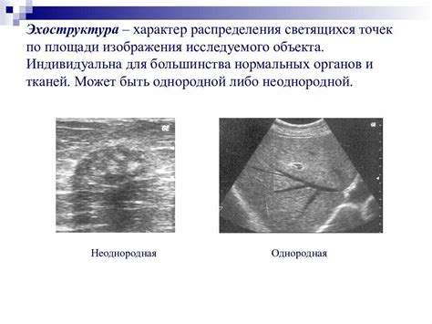 Эхоструктура печени однородная