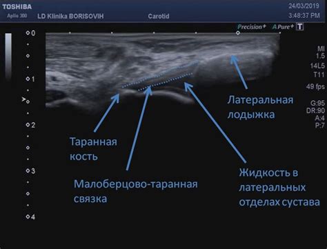  Анатомические аспекты латерального расположения 