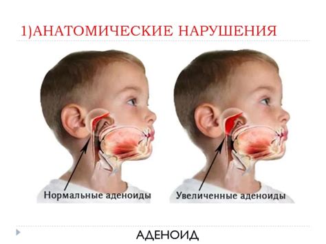  Влияние аденоидов на здоровье детей 