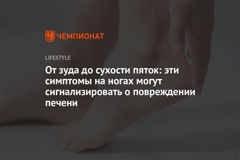  Вредные последствия сухости пяток 