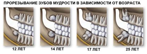  Истолкование сновидений о формировании зубов мудрости: смысл и воздействие на индивидуальную жизнь мечтателя 