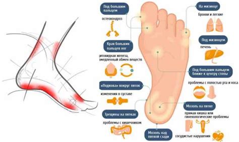  Какие заболевания могут вызывать зуд в ступнях 