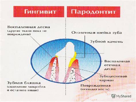  Предсказания, связанные со сновидением, где заметна значительная полость в зубе 