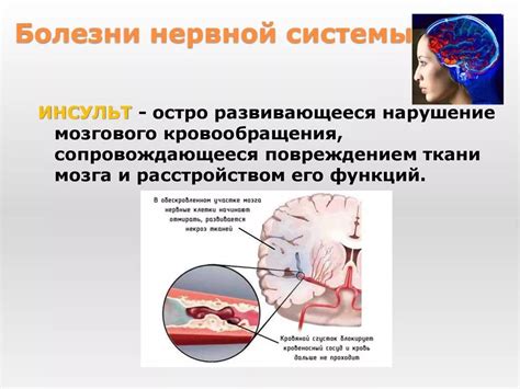  Причины, связанные с нервной системой и тревогой 