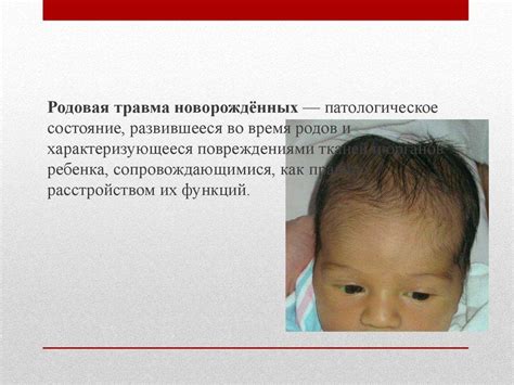  Родовая травма головы: основные последствия 